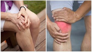 the symptoms of osteoarthritis